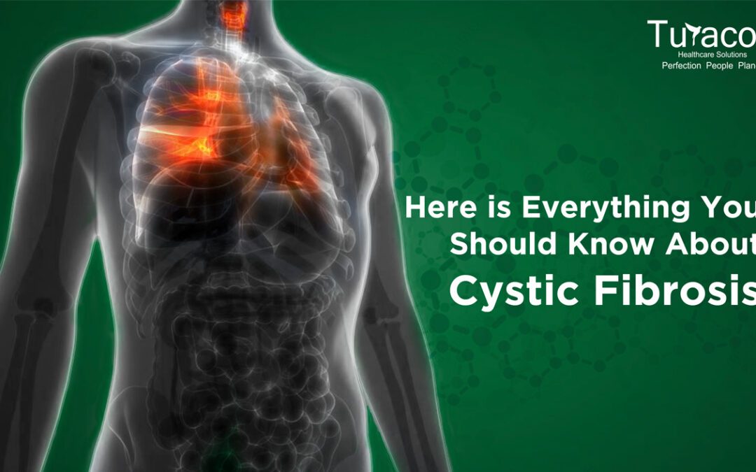 Here is Everything You Should Know About Cystic Fibrosis