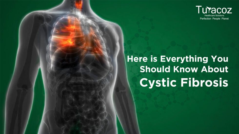 Here Is Everything You Should Know About Cystic Fibrosis Turacoz