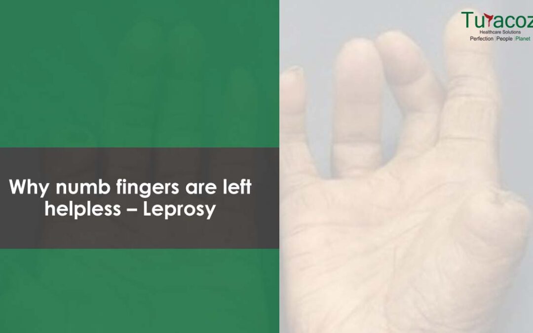 Why numb fingers are left helpless – Leprosy